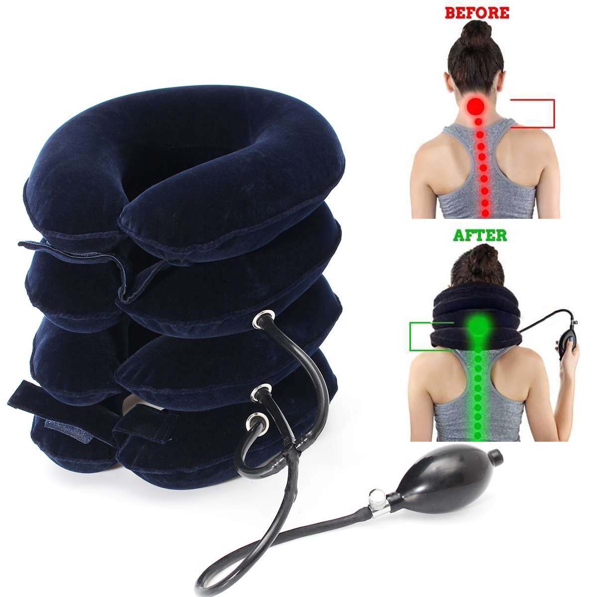 CerviRelax Neck Traction Device